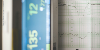 A printout of readings from an EEG machine
